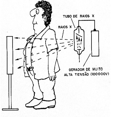 Figura 3 – A radiografia
Figura 3 – A radiografia