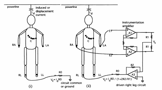 Figura 4 – A configuração normal de terra e o circuito virtual de terra para melhorar o desempenho em relação ao ruído induzido.
