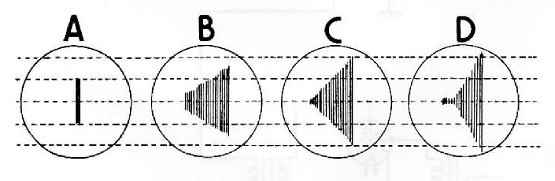 Figura 3 - Onda portadora analisada em osciloscópio; A -sem modulação; B -com 80 por cento de modulação; C -com 100 por cento de modulação; D -com excesso de modulação.
Figura 3 - Onda portadora analisada em osciloscópio; A -sem modulação; B -com 80 por cento de modulação; C -com 100 por cento de modulação; D -com excesso de modulação.