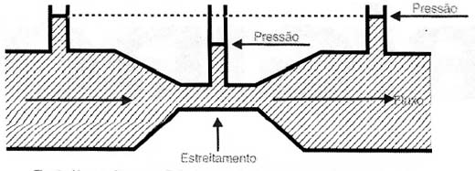 No estreitamento diminui a pressão e aumenta a velocidade do fluíco.
No estreitamento diminui a pressão e aumenta a velocidade do fluíco.