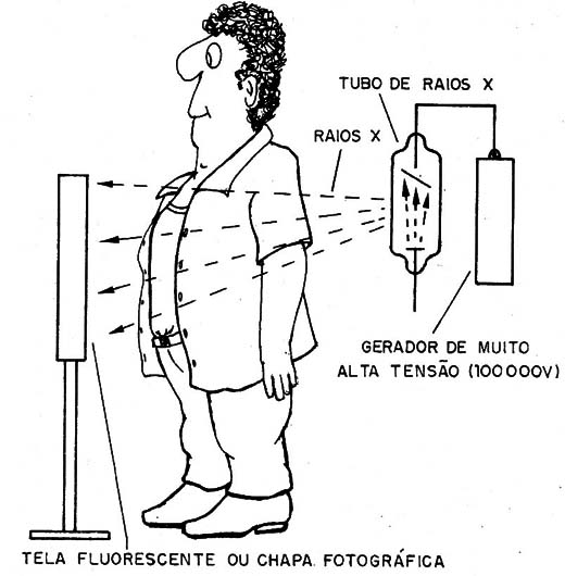 Figura 10 – A radiografia
Figura 10 – A radiografia