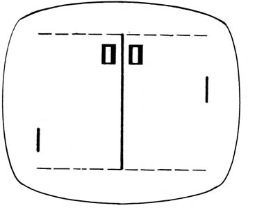Figura 15 – Imagem normal
Figura 15 – Imagem normal