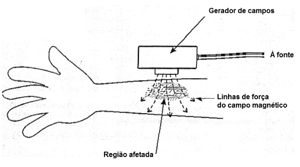 Figura 2 – Massageador magnético (MA021)
